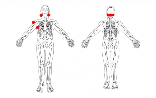 耳鳴りと肩の痛みの発生部位