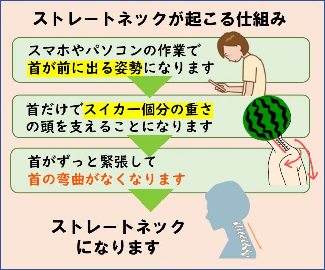 ストレートネックが起こる仕組み（図解）